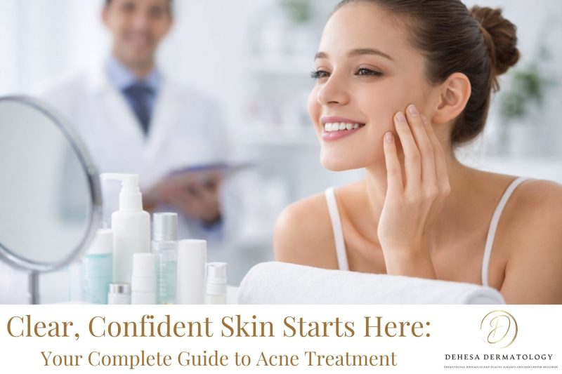 Clear, Confident Skin Starts Here Your Complete Guide to Acne Treatment